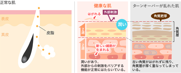 ケミカルピーリング 正常な肌