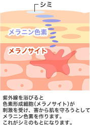 しみとは?
